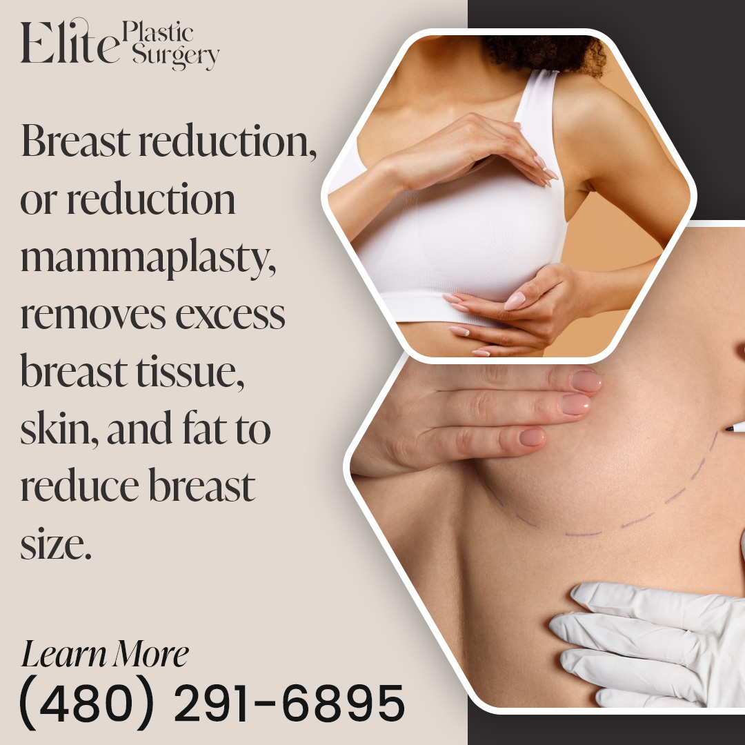 What Is Breast Reduction Surgery
